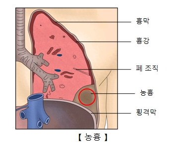 농흉