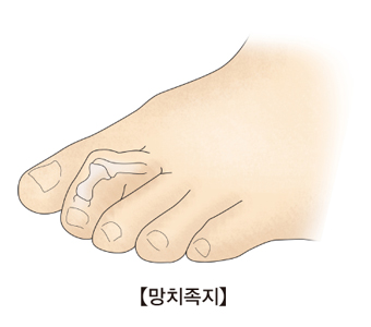 망치족지