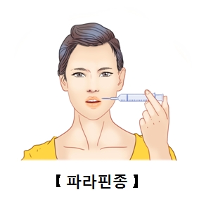 파라핀종