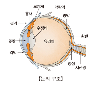 선천성 눈 기형