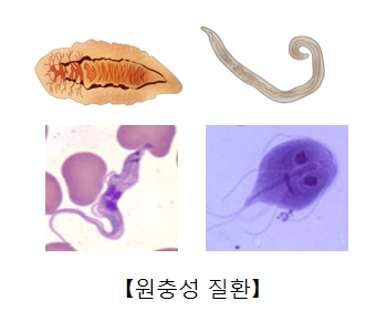 원충성 질환