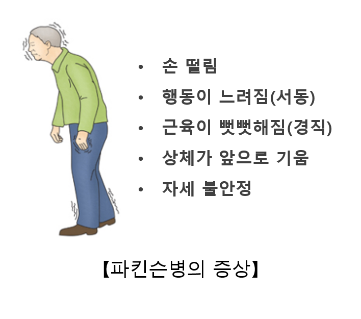 파킨슨 증후군