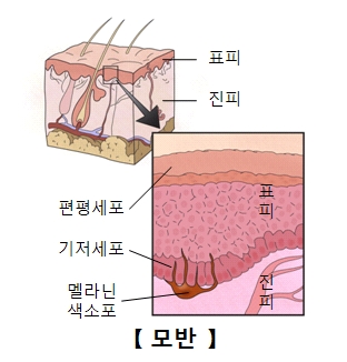 모반