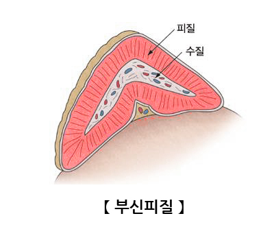 부신피질