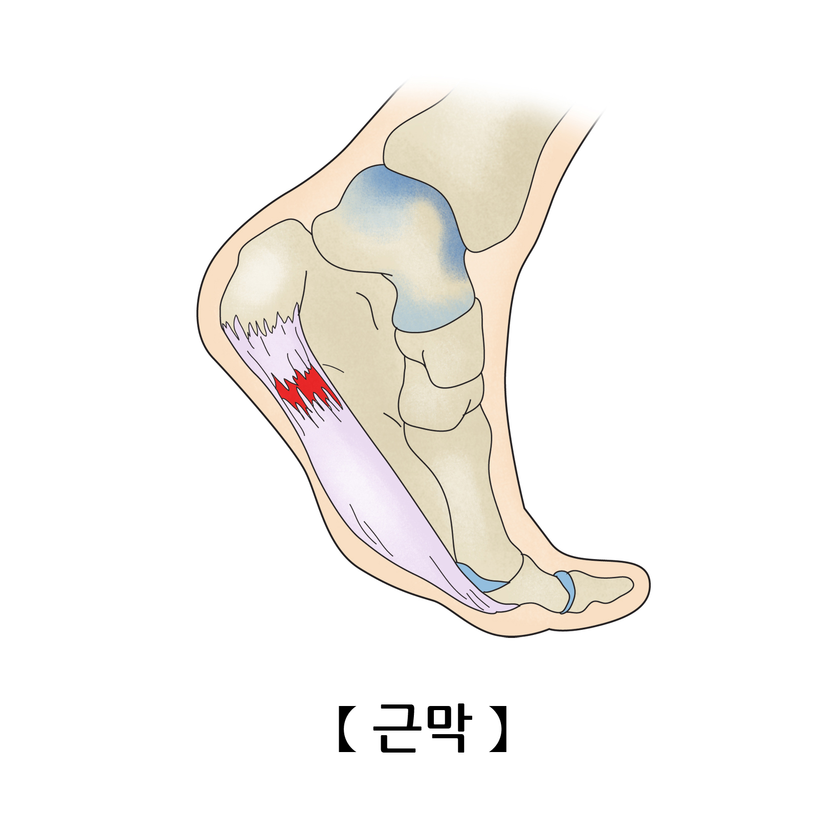 근막