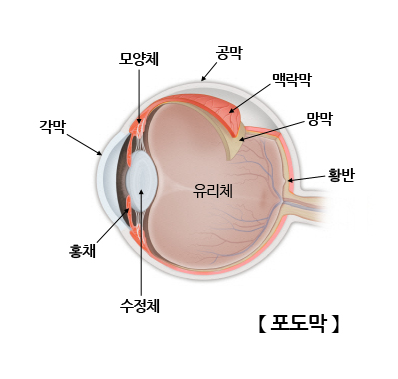 포도막